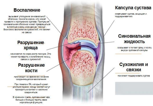 лучшие ревматологи, ревматолог что лечит, ревматолог записаться, консультация ревматолога, взрослый ревматолог, онлайн-консультация ревматолога, ревматолог боли в суставах, запись к врачу ревматологу, ревматолог онлайн, артрит ревматологи